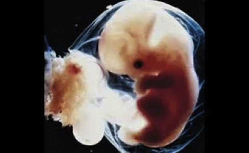 1811-embrion